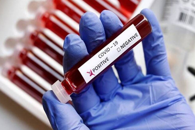 രാജ്യത്ത് കൊവിഡ്-19 കേസുകളുടെ എണ്ണം 3,961 ആയി ഉയർന്നു.